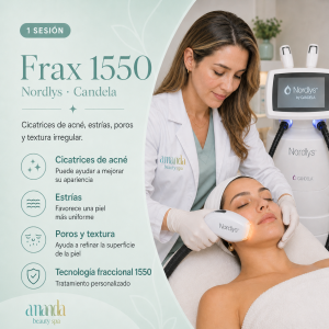 Frax 1550